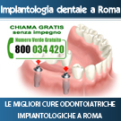 Implantologia dentale a roma
